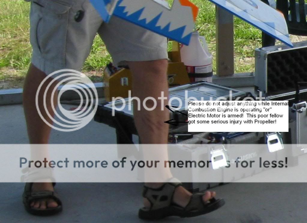 Propeller Injury Pictures, Images & Photos Photobucket